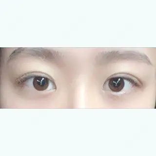 0日目の経過画像（1枚目）