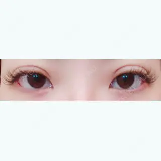 2日目の経過画像（1枚目）