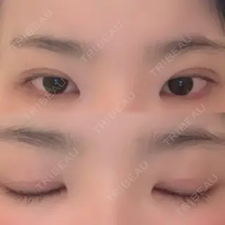 9日目の経過画像（1枚目）