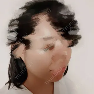 2日目の経過画像（3枚目）