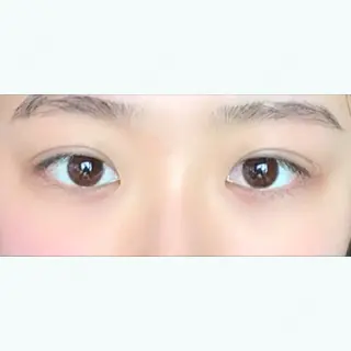 2日目の経過画像（1枚目）