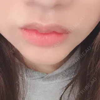 3日目の経過画像（1枚目）