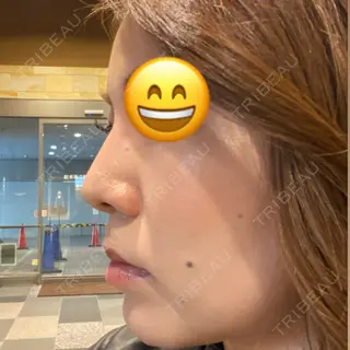 0日目の経過画像（2枚目）