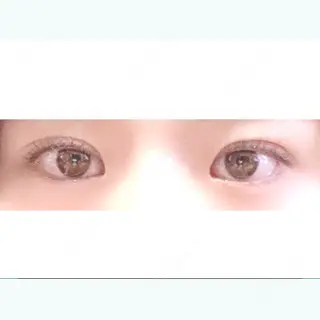 1日目の経過画像（1枚目）