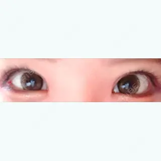 65日目の経過画像（1枚目）