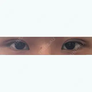 9日目の経過画像（1枚目）