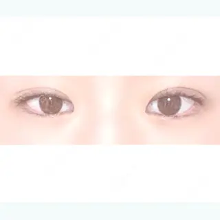 9日目の経過画像（1枚目）