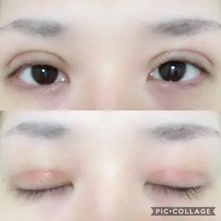 18日目の経過画像（1枚目）