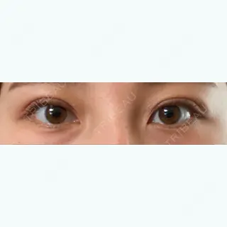 9日目の経過画像（1枚目）