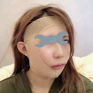 1日目の経過画像（2枚目）