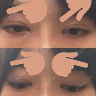 19日目の経過画像（3枚目）