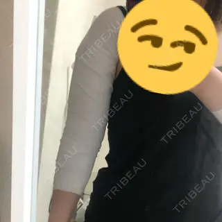 0日目の経過画像（1枚目）