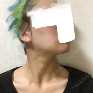 26日目の経過画像（3枚目）