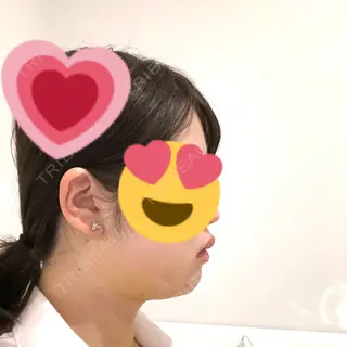 7日目の経過画像（2枚目）