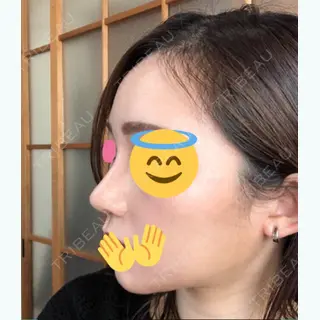 93日目の経過画像（1枚目）