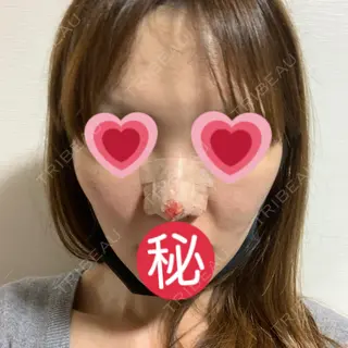 0日目の経過画像（1枚目）