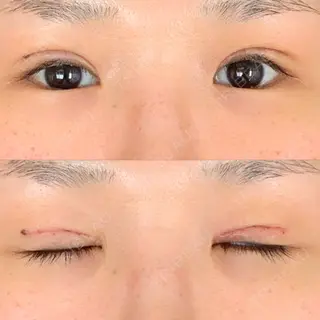 7日目の経過画像（1枚目）