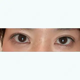 19日目の経過画像（1枚目）