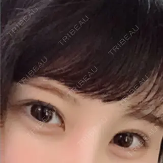 24日目の経過画像（1枚目）