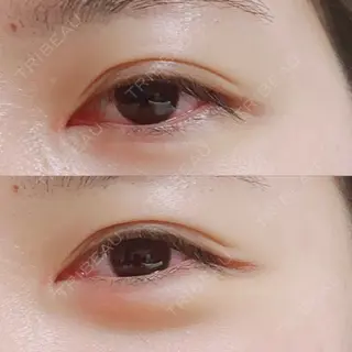 6日目の経過画像（1枚目）