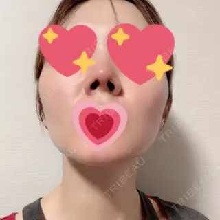2日目の経過画像（2枚目）