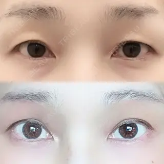 20日目の経過画像（2枚目）