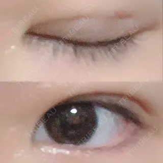 6日目の経過画像（2枚目）