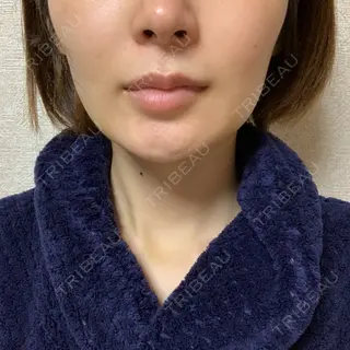 7日目の経過画像（1枚目）