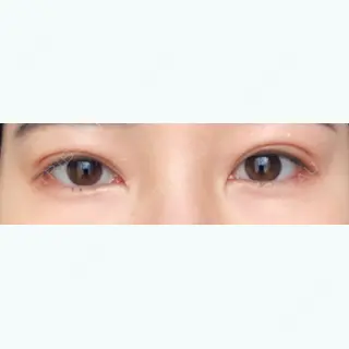 53日目の経過画像（1枚目）