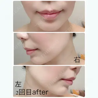 59日目の経過画像（3枚目）