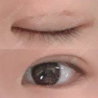 7日目の経過画像（2枚目）