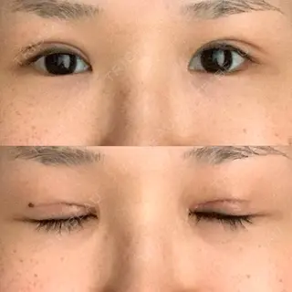 9日目の経過画像（1枚目）