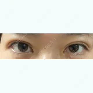 21日目の経過画像（1枚目）