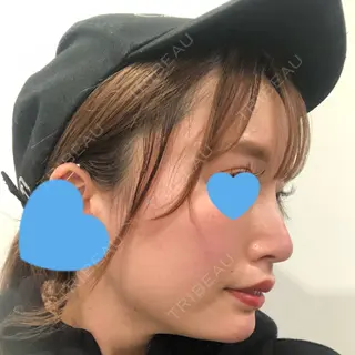 9日目の経過画像（3枚目）