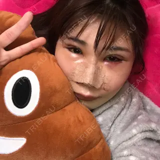 2日目の経過画像（2枚目）