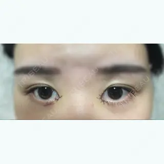 3日目の経過画像（2枚目）
