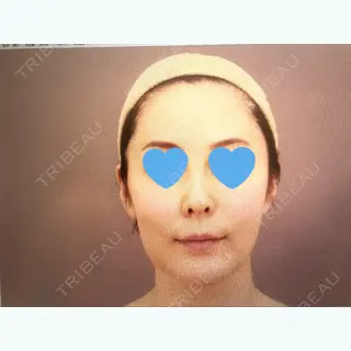 9日目の経過画像（1枚目）