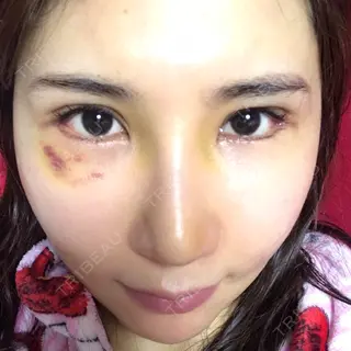 9日目の経過画像（2枚目）