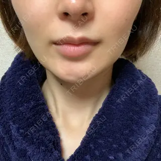 9日目の経過画像（1枚目）