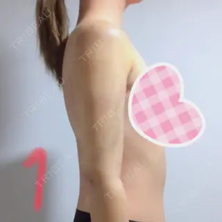 1日目の経過画像（1枚目）