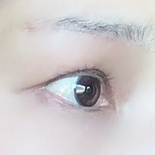 23日目の経過画像（2枚目）