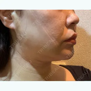 2日目の経過画像（2枚目）