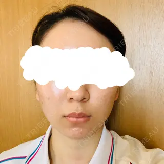 27日目の経過画像（1枚目）