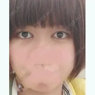 7日目の経過画像（1枚目）