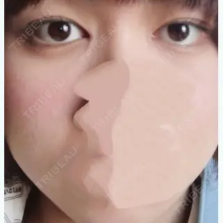 10日目の経過画像（1枚目）