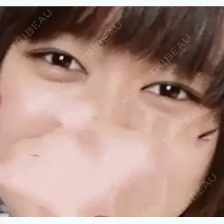 10日目の経過画像（3枚目）