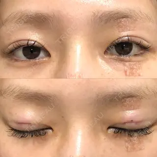 1日目の経過画像（1枚目）