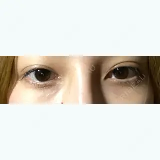 31日目の経過画像（1枚目）