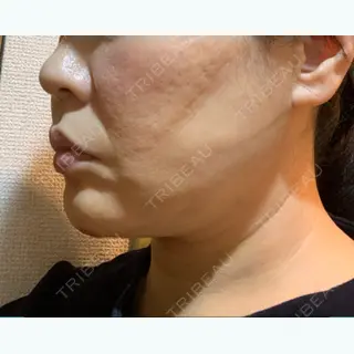 3日目の経過画像（1枚目）