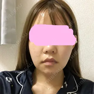 24日目の経過画像（1枚目）